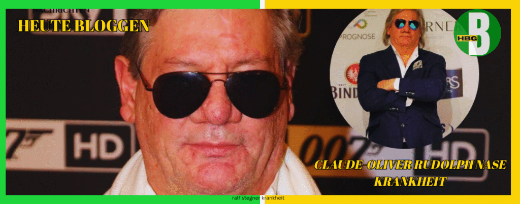 claude-oliver rudolph nase krankheit